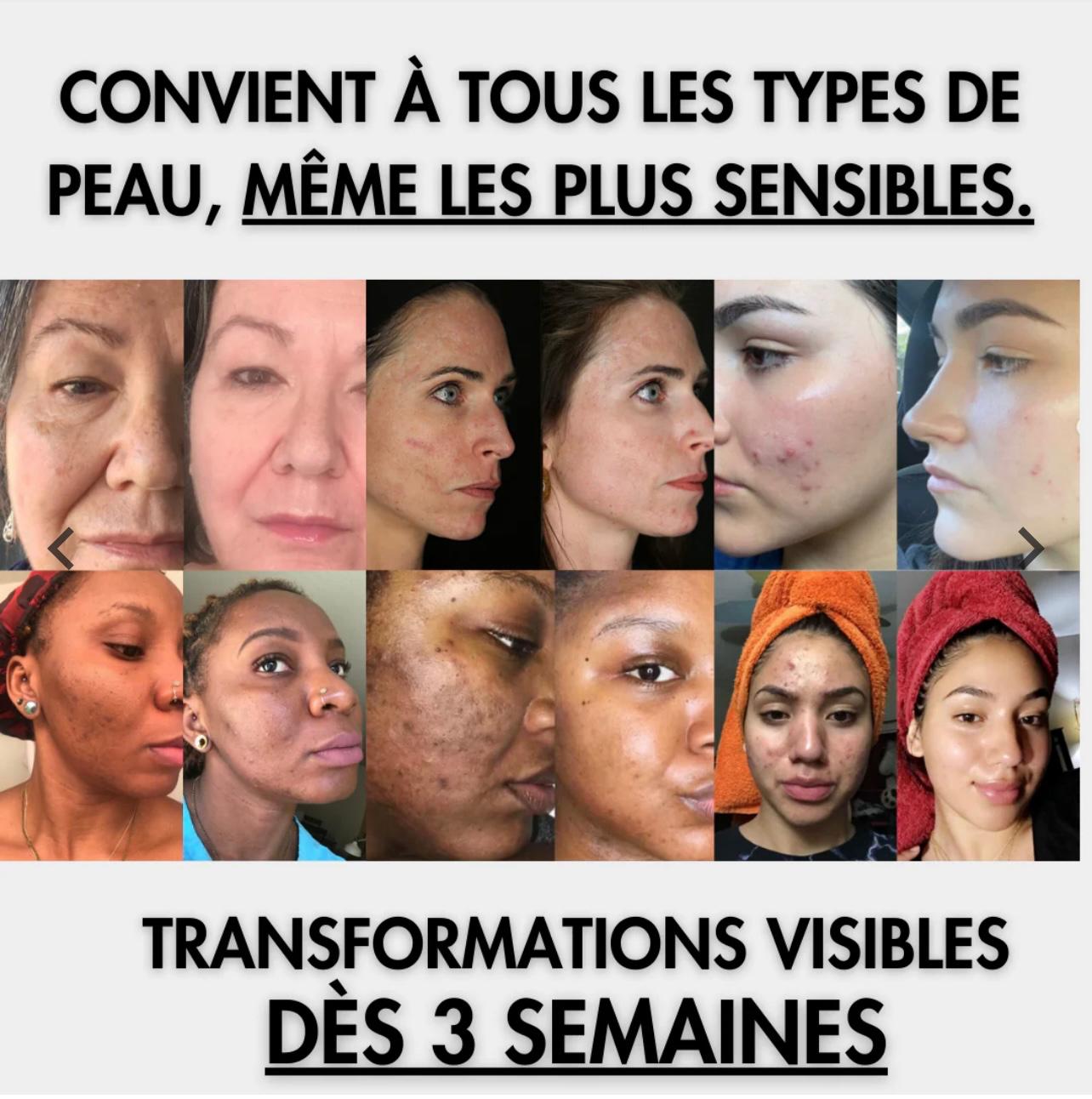 ALMA-Savon Glow & Anti-Taches Au Curcuma