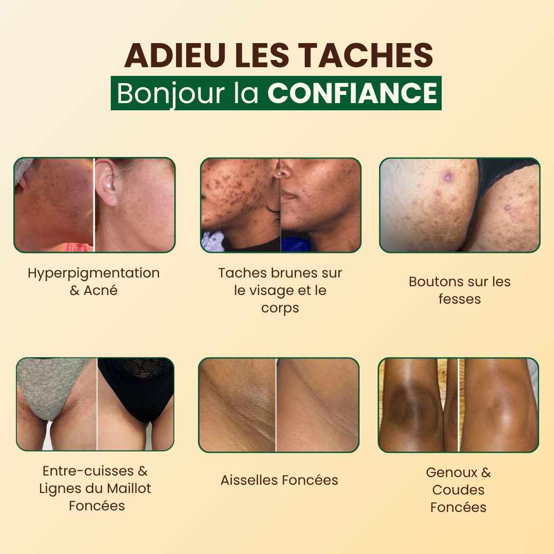 ALMA-Savon Glow & Anti-Taches Au Curcuma